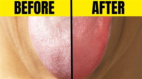 Without A Tongue .